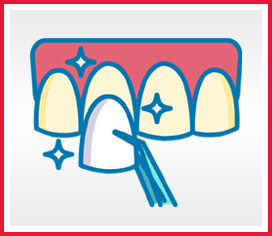 Veneers Folder